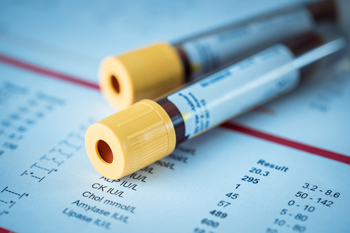 Blood test tubes